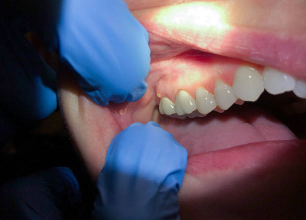 Best Emergency Denture Repair in Dayton, TX