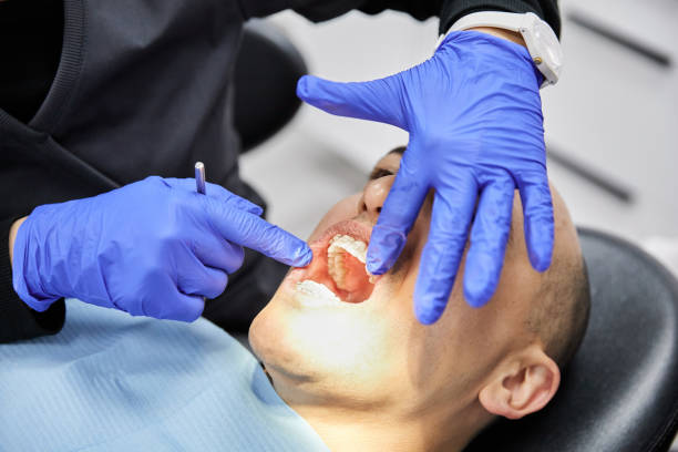 Best Emergency Wisdom Teeth Removal in Dayton, TX